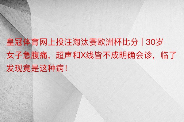 皇冠体育网上投注淘汰赛欧洲杯比分 | 30岁女子急腹痛，超声和X线皆不成明确会诊，临了发现竟是这种病！